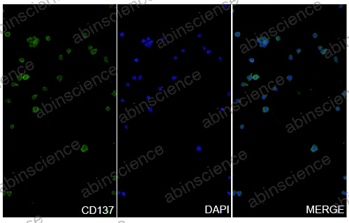 Anti-Human 4-1BB/TNFRSF9/CD137 & PD-L1 & ROR1 & CD3 epsilon Reference Antibody (Nebratamig, RUO)