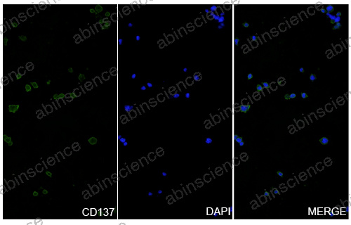 Anti-Human 4-1BB/TNFRSF9/CD137 & PD-L1 Bispecific Reference Antibody (Enristomig, RUO)