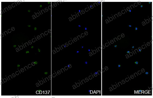 Anti-Human 4-1BB/TNFRSF9/CD137 & PD-L1 Bispecific Reference Antibody (Xirestomig, RUO)