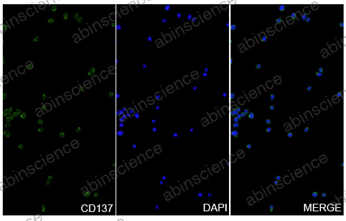 Anti-Human 4-1BB/TNFRSF9/CD137 Recombinant Antibody (SAA0054)