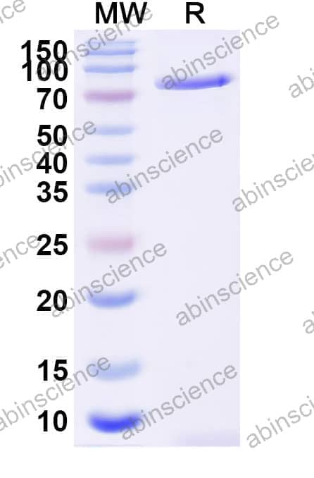 Human GAS6 Recombinant Protein (C-Fc)