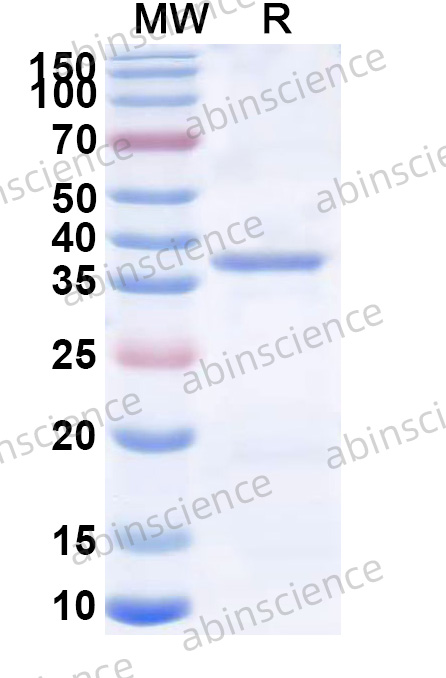 Human MELK Recombinant Protein (N-His)