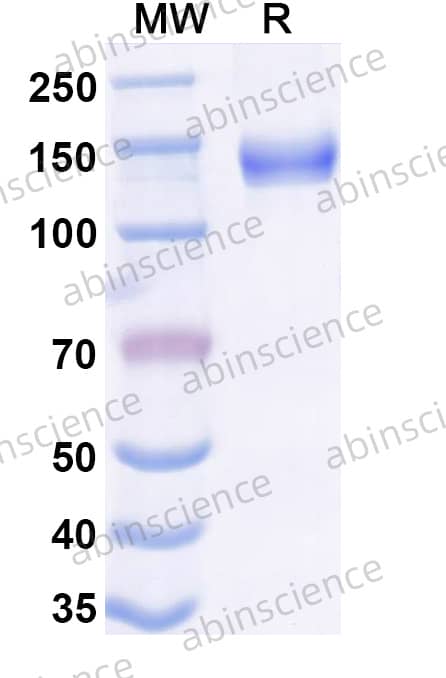 Human LAMC2 Recombinant Protein (C-His)