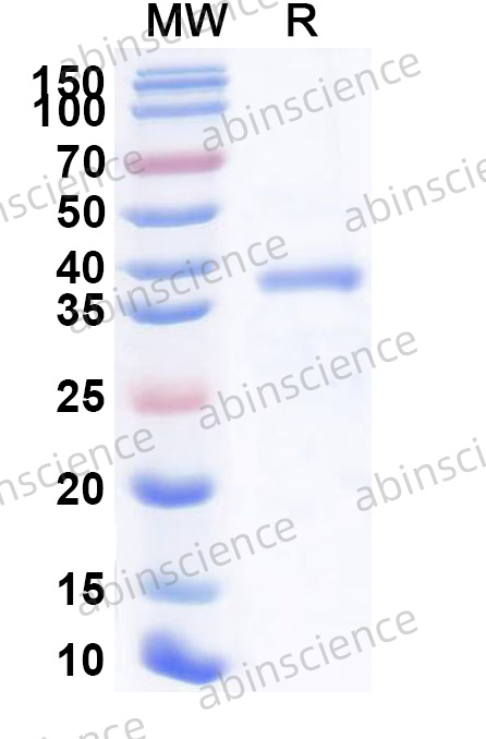 Human CRHR2 Recombinant Protein (N-GST & C-His)