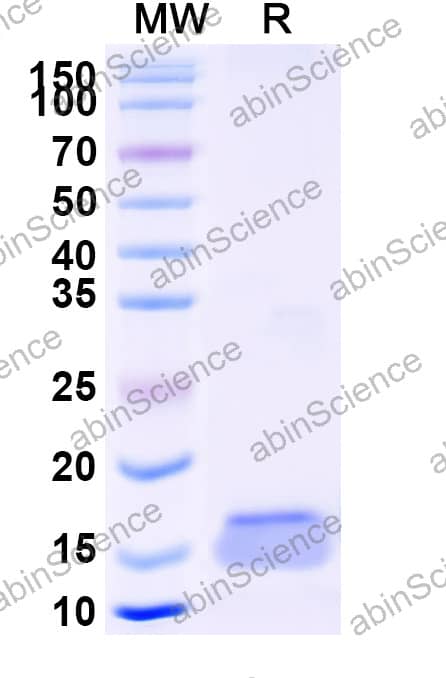 Anti-Human PTK7/CCK-4 Recombinant Nanobody (SAA2288)
