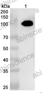 Anti-Human PTK7/CCK-4 Recombinant Nanobody (SAA2288)