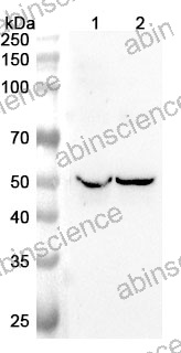 Anti-Human CLN3 Polyclonal Antibody