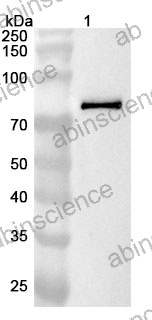 Anti-Human CALD1 Polyclonal Antibody