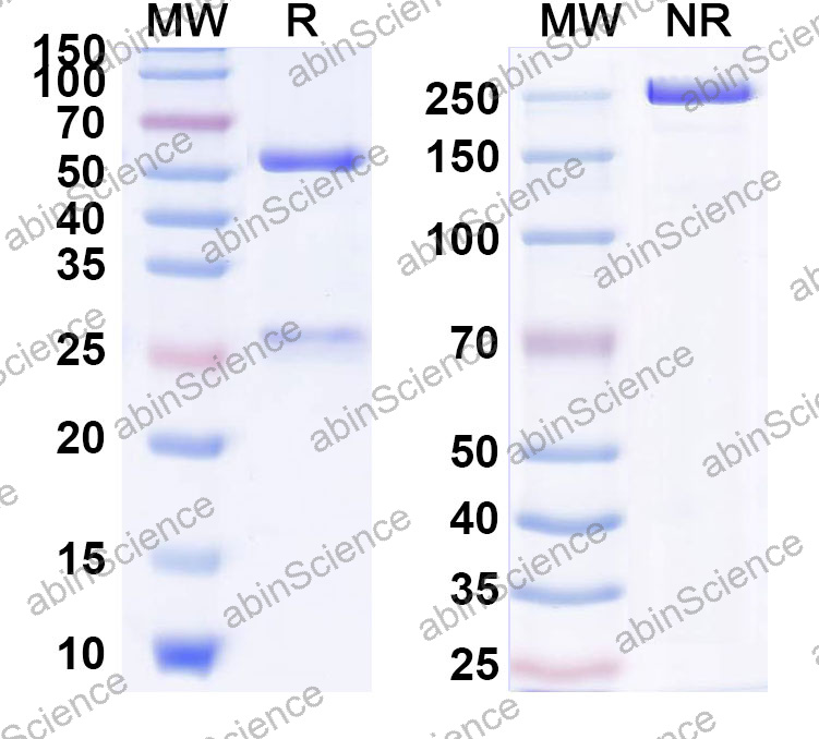 Anti-Human CALD1 Monoclonal Antibody (1A552)