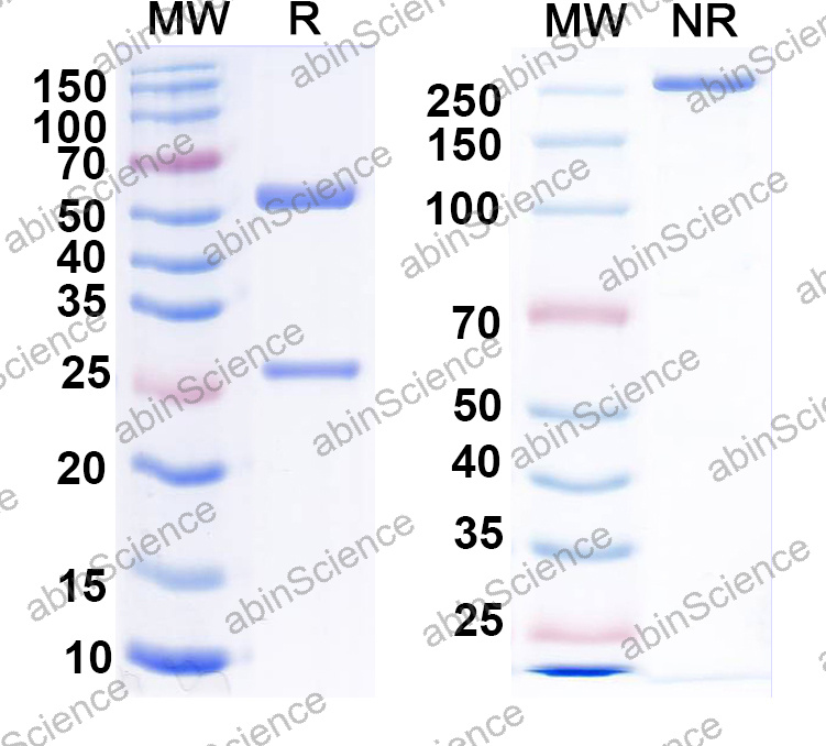 Anti-Human MSLN/Mesothelin Monoclonal Antibody (1A585)