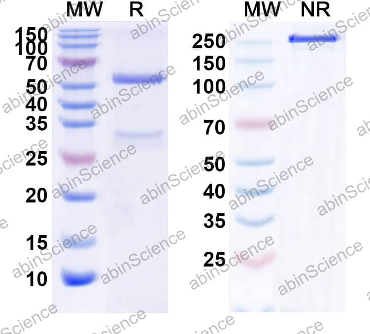 Anti-Human IL18/IL1F4 Monoclonal Antibody (1A151)