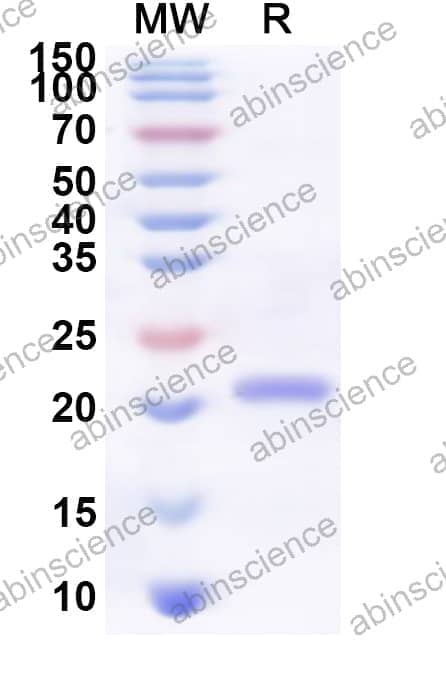 Human ACVR2B Recombinant Protein (N-His)