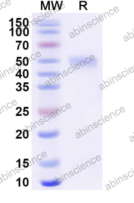 Human CD213a2/IL13RA2 Recombinant Protein (C-His)