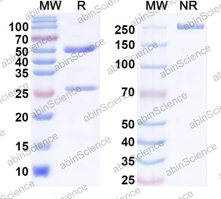 Anti-Strumpellin Recombinant Antibody (N311/32)