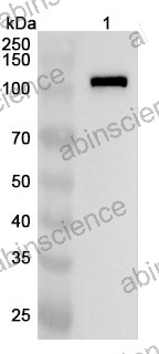 Anti-Human NFATC3 Polyclonal Antibody