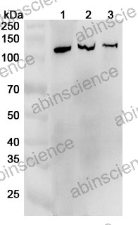 Anti-LRP8 Polyclonal Antibody