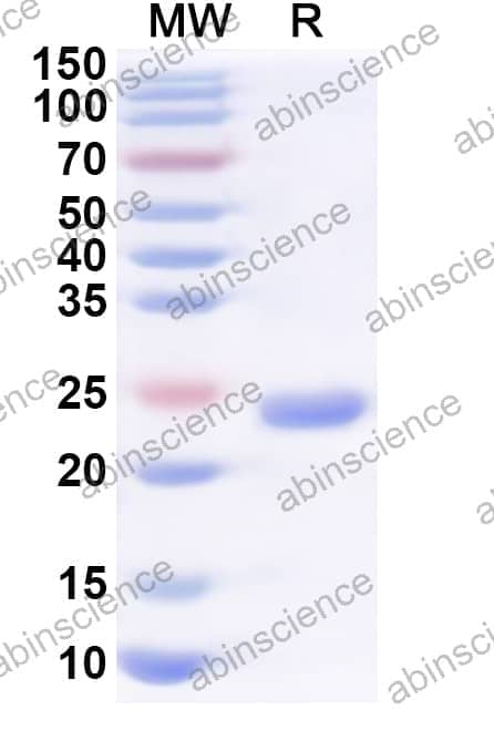 Human DLG1 Recombinant Protein (N-His)