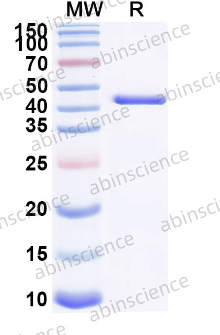 Human JRKL Recombinant Protein (N-His)