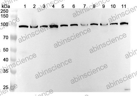 Anti-Human SPART Polyclonal Antibody