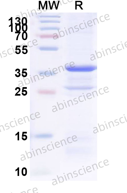 Human GNAT3 Recombinant Protein (N-His)
