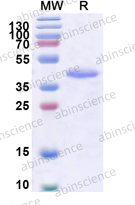 Human SRD5A1 Recombinant Protein (N-His-KSI)