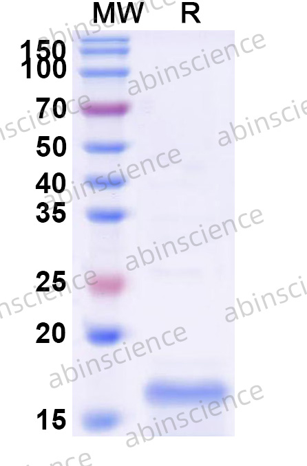 Human ZBTB14 Recombinant Protein (N-His)