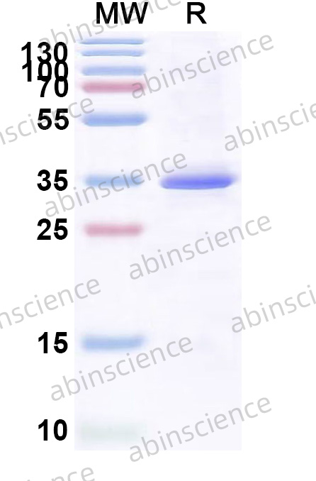 Human CCNT1 Recombinant Protein (N-His)