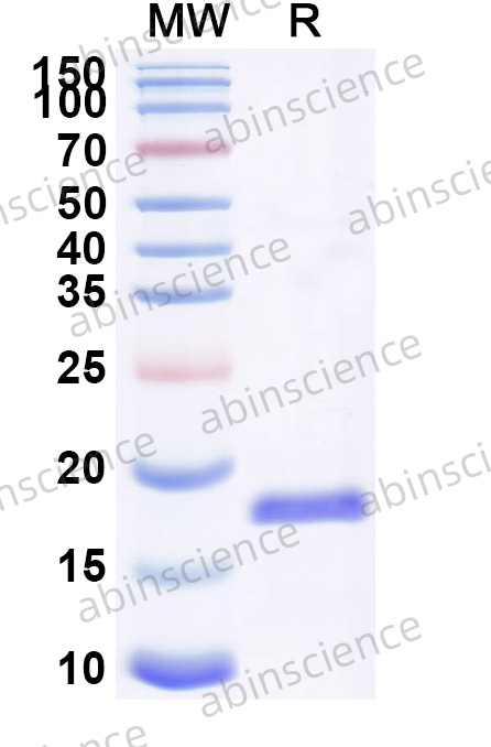 Human ZCCHC3 Recombinant Protein (N-His)