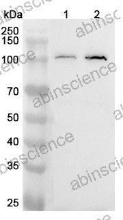 Anti-Human PRPF6 Polyclonal Antibody