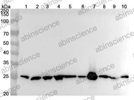 Anti-Human BNIP1 Polyclonal Antibody
