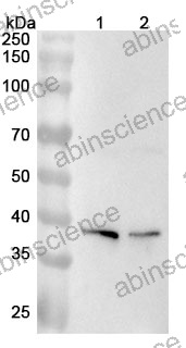 Anti-Human GFUS Polyclonal Antibody