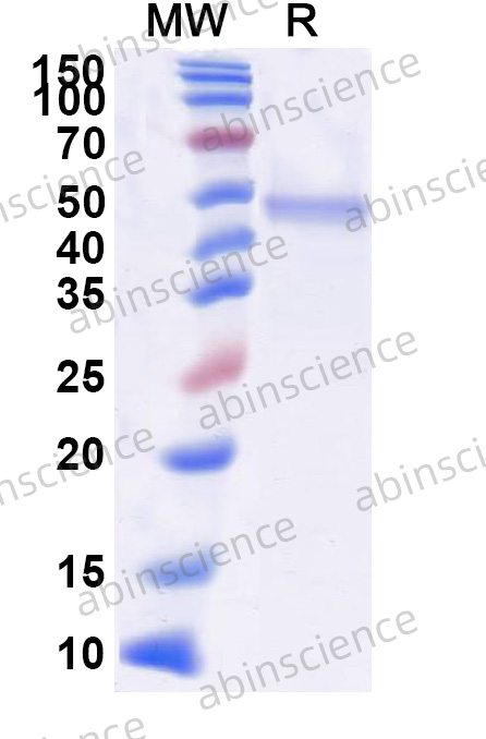 Human DIP2A Recombinant Protein (N-His)