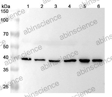 Anti-Human TWF2 Polyclonal Antibody