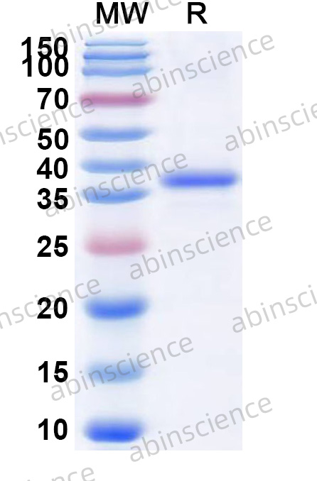 Human USP53 Recombinant Protein (N-His)