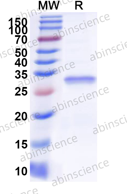 Human RHEX Recombinant Protein (N-His)