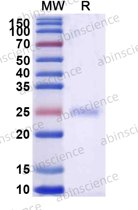 Human TRAF7 Recombinant Protein (N-His)