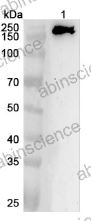 Anti-Human EDC4 Polyclonal Antibody