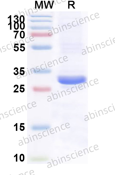 Human SIAH1 Recombinant Protein (N-His)