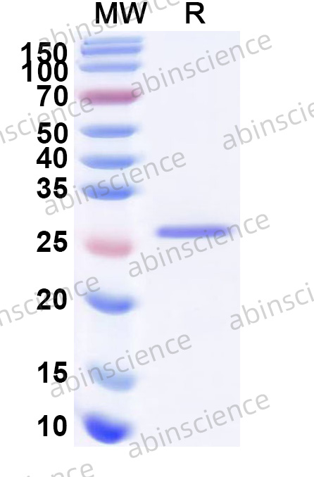 Human TMEM59 Recombinant Protein (N-His)