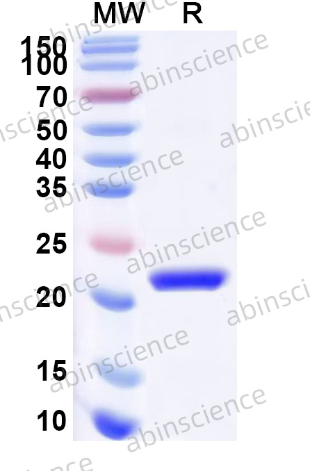 Human IMP3 Recombinant Protein (N-His)