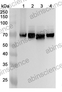 Anti-DPYSL3 Polyclonal Antibody