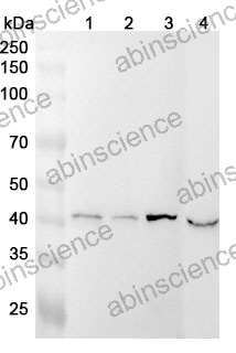 Anti-BCKDK Polyclonal Antibody