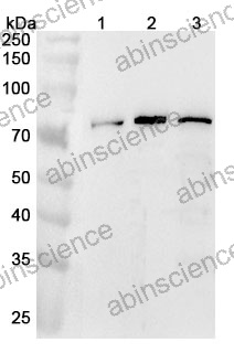 Anti-LRCH4 Polyclonal Antibody