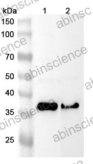 Anti-Human HSD17B2 Polyclonal Antibody