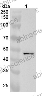 Anti-GALK2 Polyclonal Antibody
