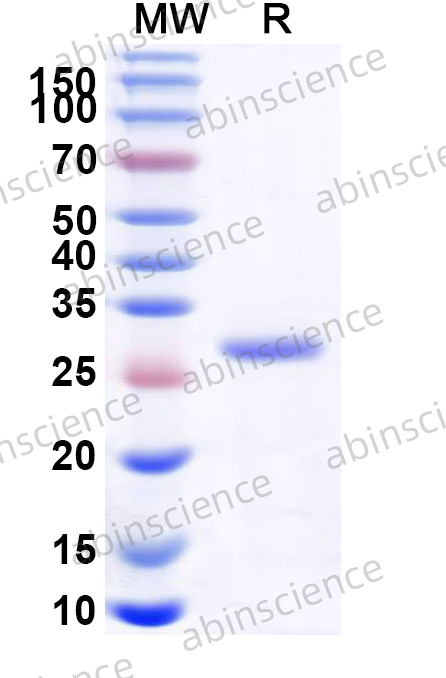 Human SLAMF9 Recombinant Protein (N-His)