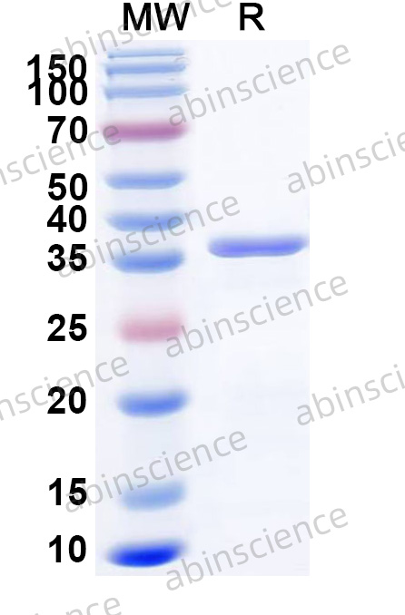 Human CDHR3 Recombinant Protein (N-His)