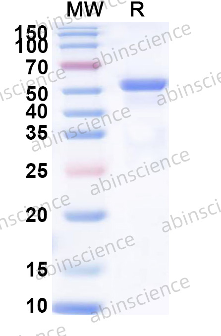 Human MORC3 Recombinant Protein (N-His)