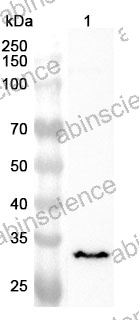 Anti-Human RPL8 Polyclonal Antibody