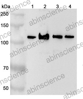 Anti-Human NCOR1 Polyclonal Antibody